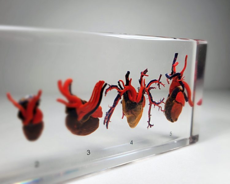 Real Hearts Display, Comparative Hearts, Hearts In Resin
